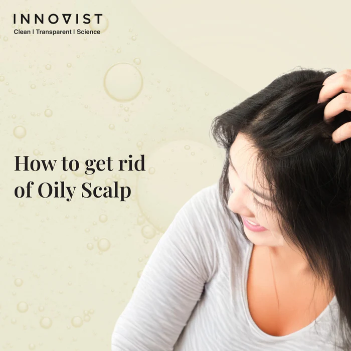 Home how to get rid of oily scalp 1 1